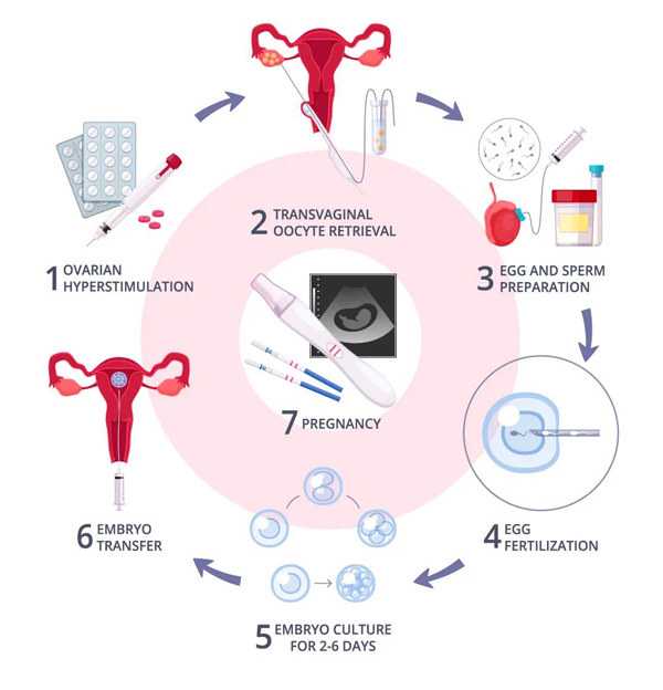 aa69吕进峰试管助孕机构|包头供卵试管的过程：包头一附院做试管婴儿